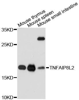 Western blot - TNFAIP8L2 antibody (144-60451)