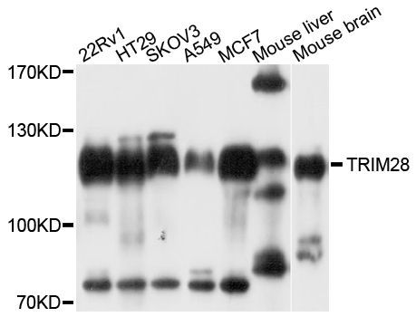 Western blot - TRIM28 antibody (144-02245)