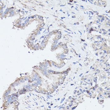Western blot - MAP1LC3B Polyclonal Antibody (144-11282)