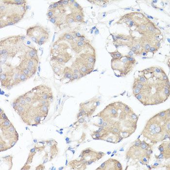 Immunohistochemistry - CLUH Polyclonal Antibody (144-010140)