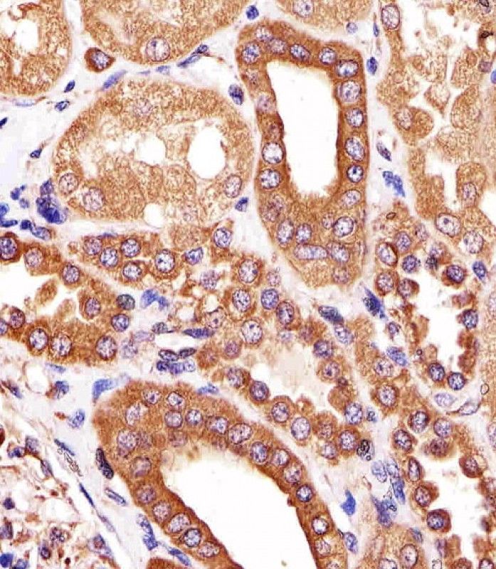 IHC-P