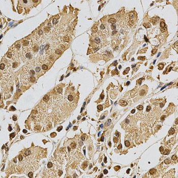 Immunohistochemistry - XRCC3 antibody (144-02134)