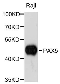 Western blot - PAX5 antibody (144-03068)