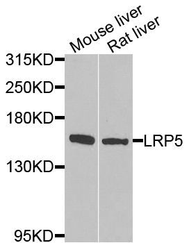 Western blot - LRP5 Polyclonal Antibody (144-00130)