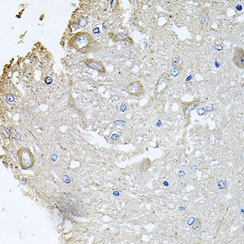 Immunohistochemistry - CHCHD3 Polyclonal Antibody (144-08584)