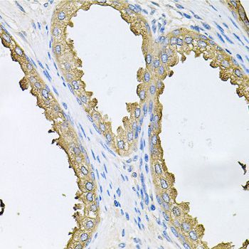 Immunohistochemistry - ABL1 Polyclonal Antibody (144-00282)