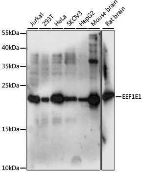 Western blot - EEF1E1 antibody (144-61013)