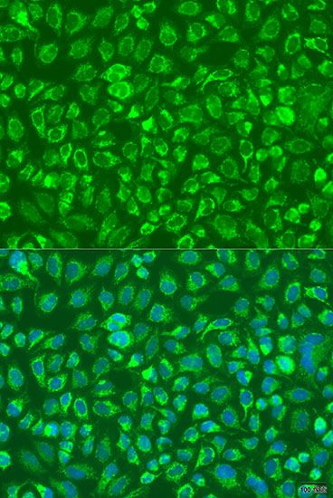 Immunofluorescence - C5 antibody (144-08104)