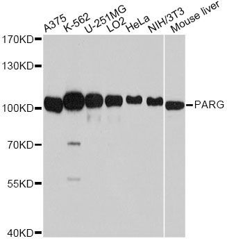 Western blot - PARG Polyclonal Antibody (144-10577)