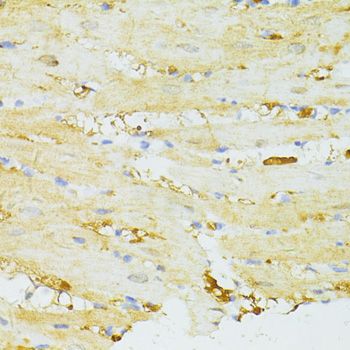 Immunohistochemistry - SIRT2 antibody (144-12575)
