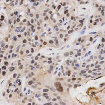 Immunohistochemistry - KPNA4 Antibody (144-02026)