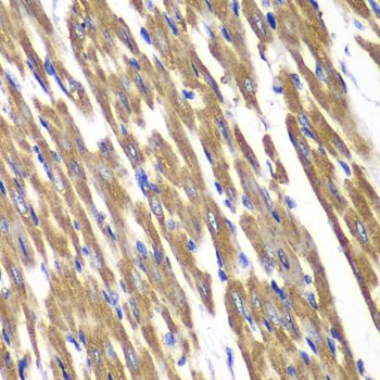Immunohistochemistry - SDHA Polyclonal Antibody (144-02594)