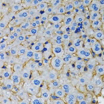 Western blot - RAF1 Polyclonal Antibody (144-00223)