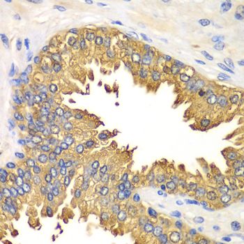Immunohistochemistry - DDX58 Polyclonal Antibody (144-00550)