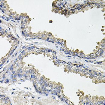 Immunohistochemistry - ACO1 antibody (144-07867)