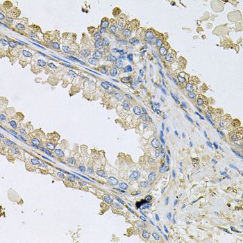 Immunohistochemistry - PPIC antibody (144-09837)
