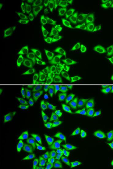 Immunofluorescence - DDX3X Polyclonal Antibody (144-05637)