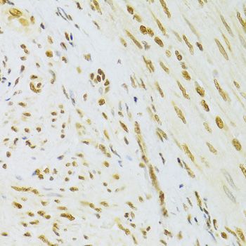 Immunohistochemistry - HMGB1 Polyclonal Antibody (144-02553)