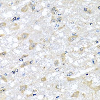 Immunohistochemistry - RPLP1 Polyclonal Antibody (144-06725)