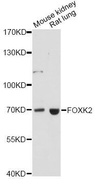 Western blot - FOXK2 antibody (144-60619)