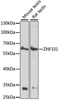 Western blot - ZNF331 antibody (144-61070)