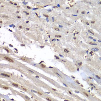 Immunohistochemistry - HNRNPM Polyclonal Antibody (144-06937)