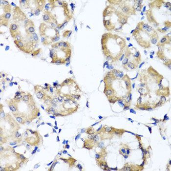 Immunohistochemistry - RBP2 antibody (144-06717)