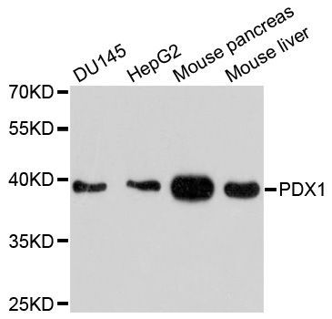 Western blot - PDX1 Polyclonal Antibody (144-010173)