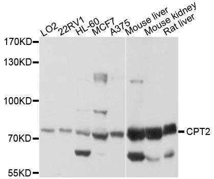 Western blot - CPT2 Polyclonal Antibody (144-012426)