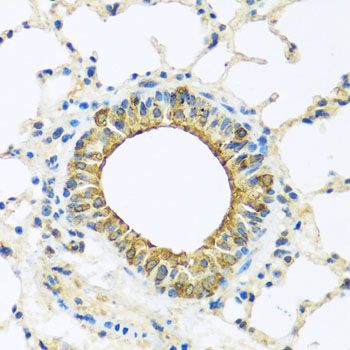 Immunohistochemistry - DCP2 antibody (144-08282)