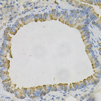 Immunohistochemistry - AZGP1 Polyclonal Antibody (144-61415)