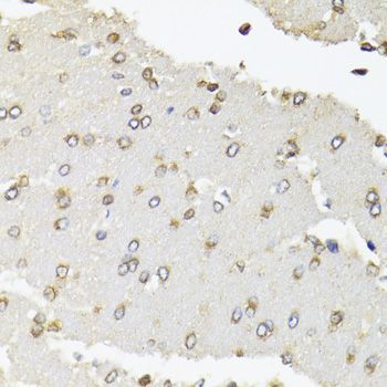 Immunohistochemistry - POLR2B Polyclonal Antibody (144-05928)