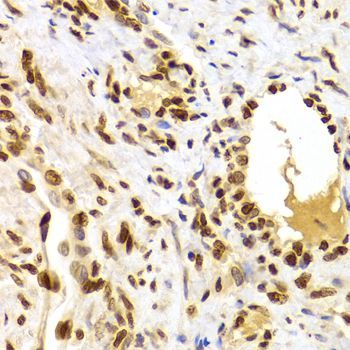 Immunohistochemistry - HMGB1 Polyclonal Antibody (144-02553)