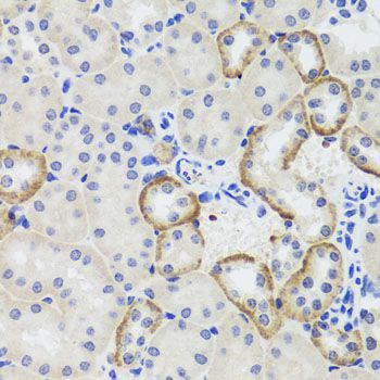 Immunohistochemistry - MTERFD3 antibody (144-08518)
