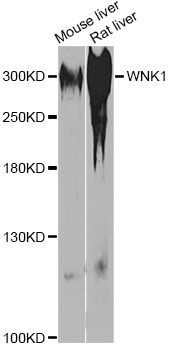 Western blot - WNK1 antibody (144-60600)