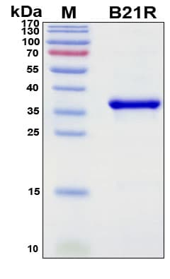 SDS-PAGE Image