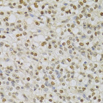 Immunohistochemistry - HDGF Antibody (144-05347)