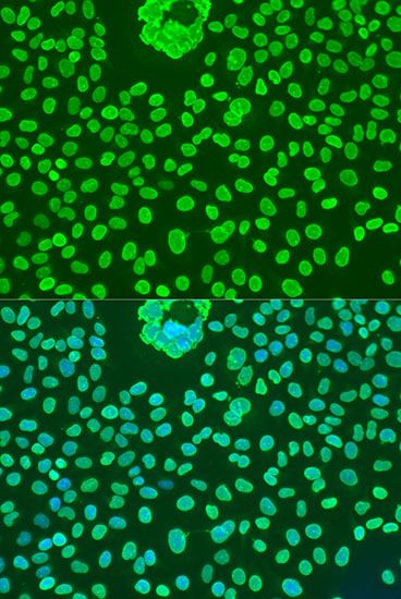 Immunofluorescence - POU5F1 Polyclonal Antibody (144-07920)