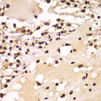 Immunohistochemistry - ZNF20 antibody (144-07346)