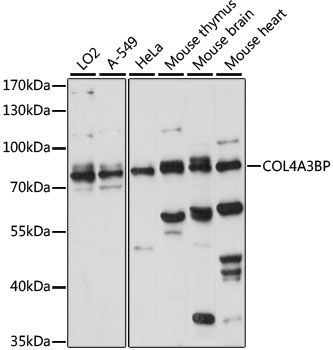 Western blot - COL4A3BP antibody (144-015376)