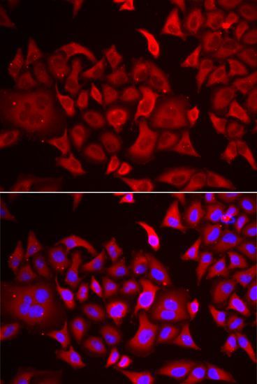 Immunofluorescence - TARS antibody (144-06993)