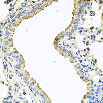 Immunohistochemistry - CHCHD3 Polyclonal Antibody (144-08584)