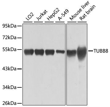 Western blot - TUBB8 antibody (144-12617)