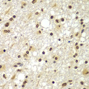Immunohistochemistry - ZNF20 antibody (144-07346)