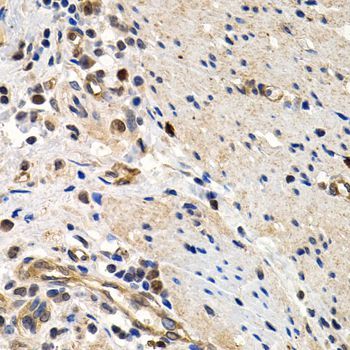 Immunohistochemistry - MCM2 Polyclonal Antibody (144-01056)