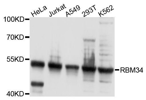 Western blot - RBM34 Polyclonal Antibody (144-010139)