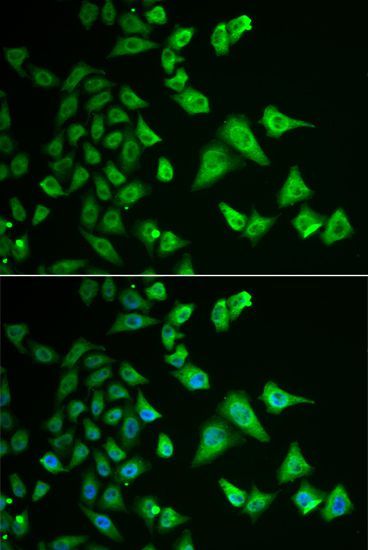 Immunofluorescence - DHRS2 antibody (144-06446)