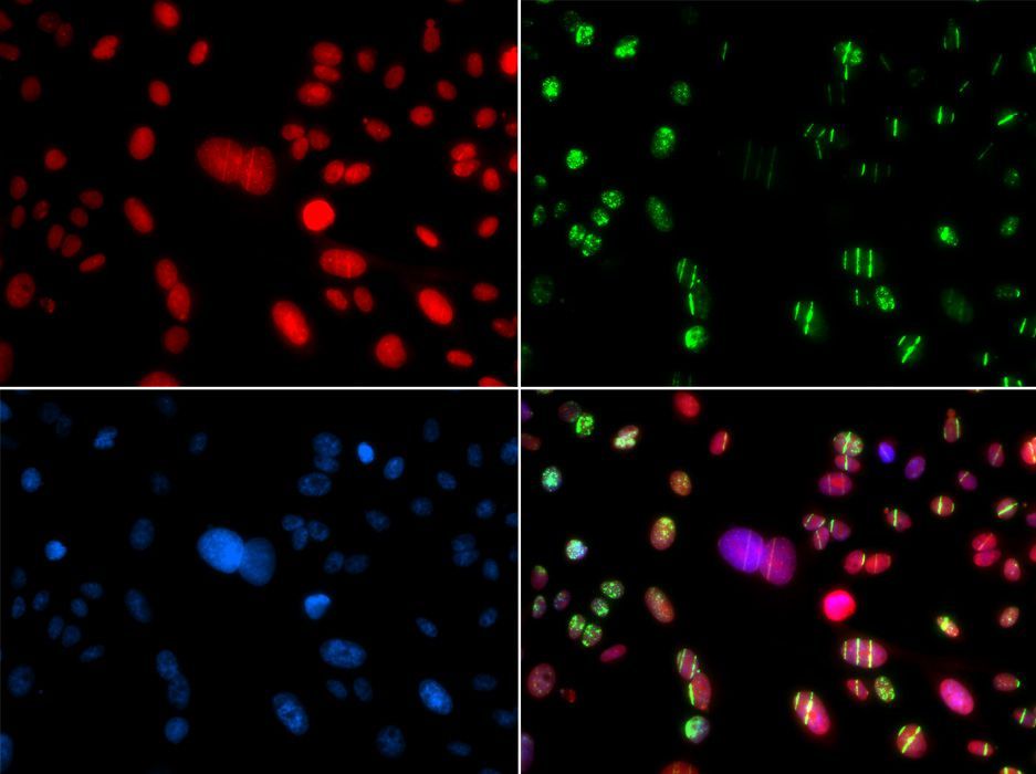 Immunofluorescence - RAG2 Polyclonal Antibody (144-05626)