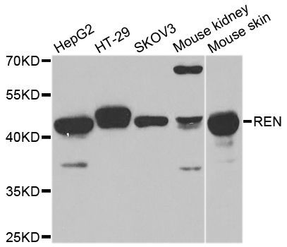 Western blot - REN antibody (144-01585)
