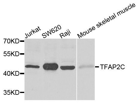 Western blot - TFAP2C antibody (144-07739)